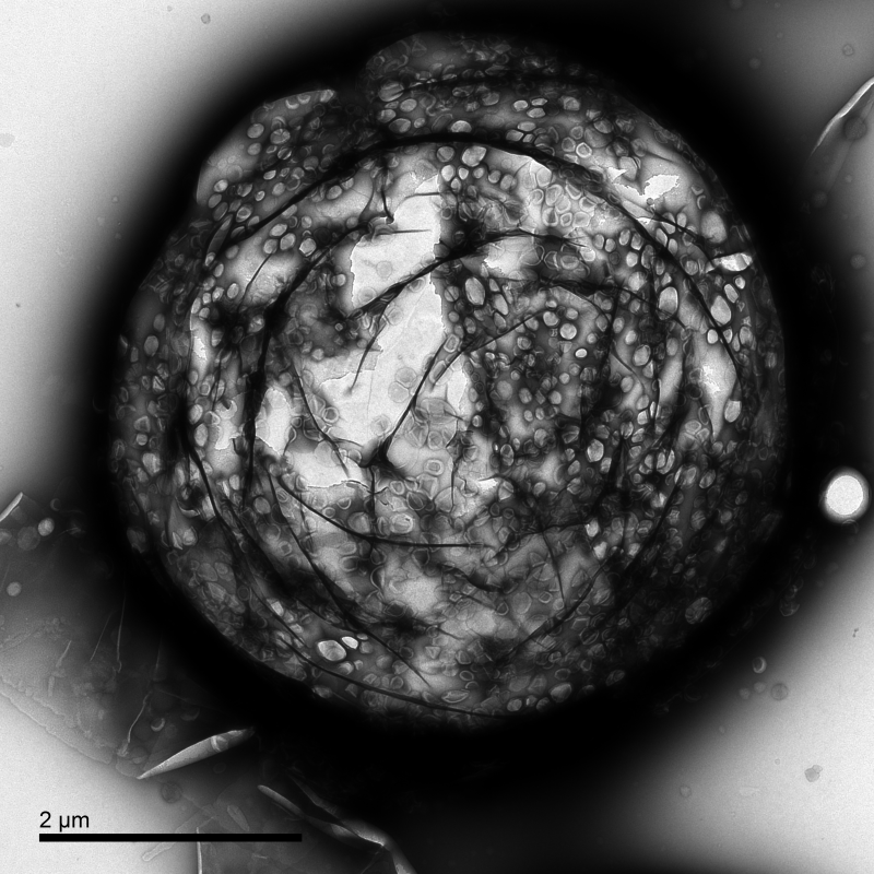Una imagen de microscopio electrónico de transmisión sin procesar. Por Estelle Beguin – Universidad de Oxford. (Imagen: EPSRC)